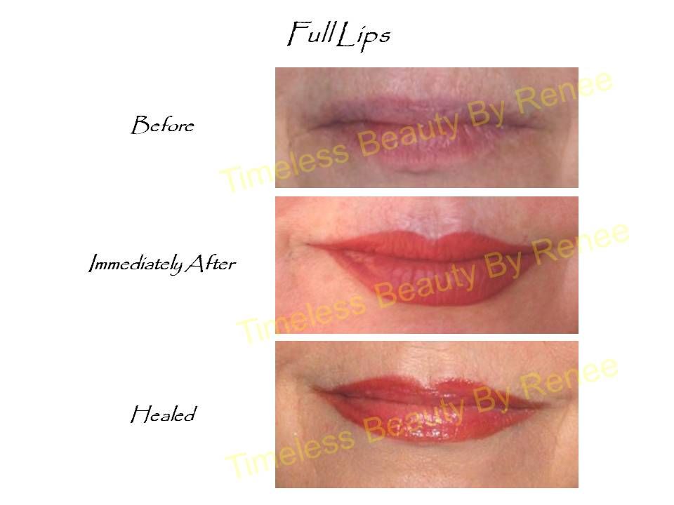 A before and after picture of a woman 's lips.