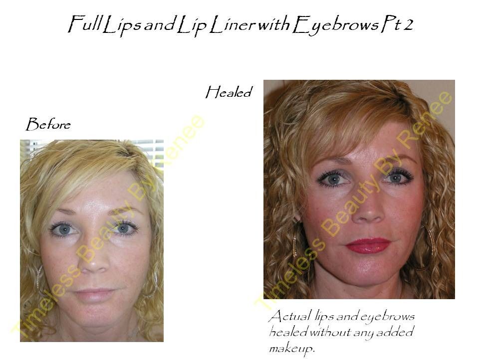 A before and after photo of a woman with full lips and lip liner with eyebrows