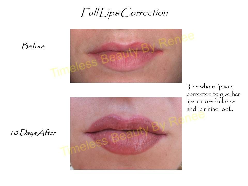 A before and after photo of a woman 's full lips correction