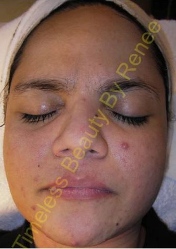 A close up of a woman 's face with the words timeless beauty by renee below it