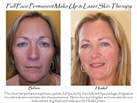 A before and after photo of a woman 's face with permanent makeup and laser skin therapy.