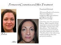 A before and after picture of a woman 's face with permanent cosmetics and skin treatment.