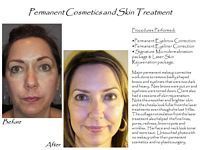 A before and after photo of a woman 's face with permanent cosmetics and skin treatment.