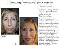 A before and after photo of a woman 's face with permanent cosmetics and skin treatment.