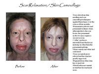 There is a before and after picture of a woman 's face.