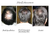Three pictures of a man 's hair before and after hair enhancement.