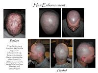 A picture of a man 's head before and after hair enhancement.