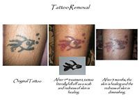 A before and after picture of a tattoo on a person 's leg.