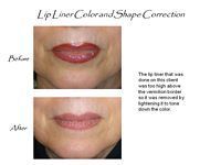 A before and after picture of a woman 's lips with lip liner color and shape correction.