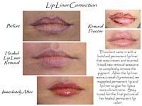 A before and after picture of a woman 's lips with lip liner correction.
