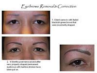 A before and after picture of a woman 's eyebrows removal and correction.