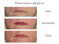A before and after picture of a woman 's lips and lip liner.