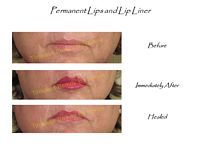 A before and after picture of a woman 's lips and lip liner.
