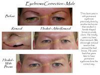 A picture of a man 's eyebrows before and after correction.