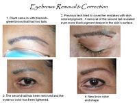 A picture of a woman 's eyebrows before and after removal and correction.