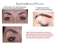 A picture of a woman 's eyebrow removal process.