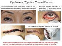 A woman is getting her eyebrows and eyeliner removed.