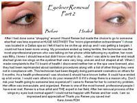 A before and after picture of a woman 's eye liner removal.