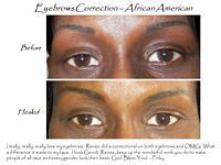 A before and after picture of a woman 's eyebrows.