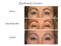 A before and after picture of a woman 's eyebrows.