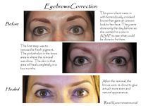 A before and after picture of a woman 's eyebrows.