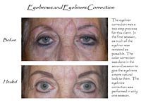 A before and after picture of a woman 's eyebrows and eyeliners correction.