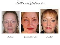 Three pictures of a woman 's face before and after a full face light brunette.