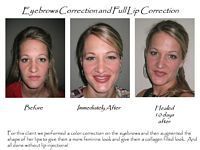 Three pictures of a woman before and after eyebrow correction and full lip correction.