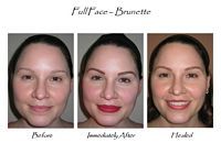 Three pictures of a woman 's face before and after getting a full face - brunette.