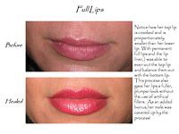 A before and after picture of a woman 's lips.