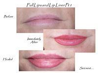 A before and after picture of a woman 's lips.