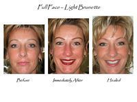 Three pictures of a woman 's face before and after a full face light brunette.