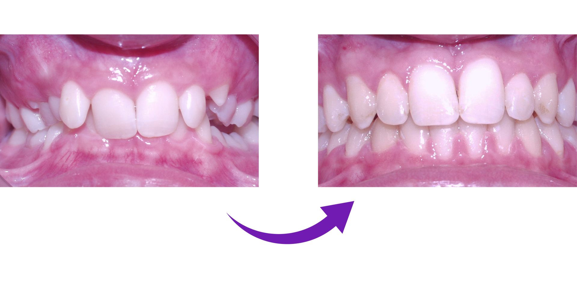 Before & After | Twinsburg, OH | 330-474-1317