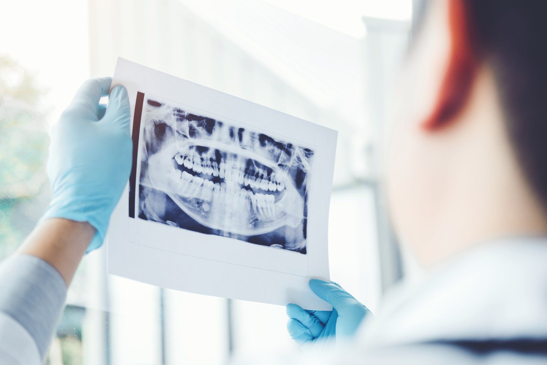 X-Rays — Cornelia, GA — Elite Dentistry of Habersham
