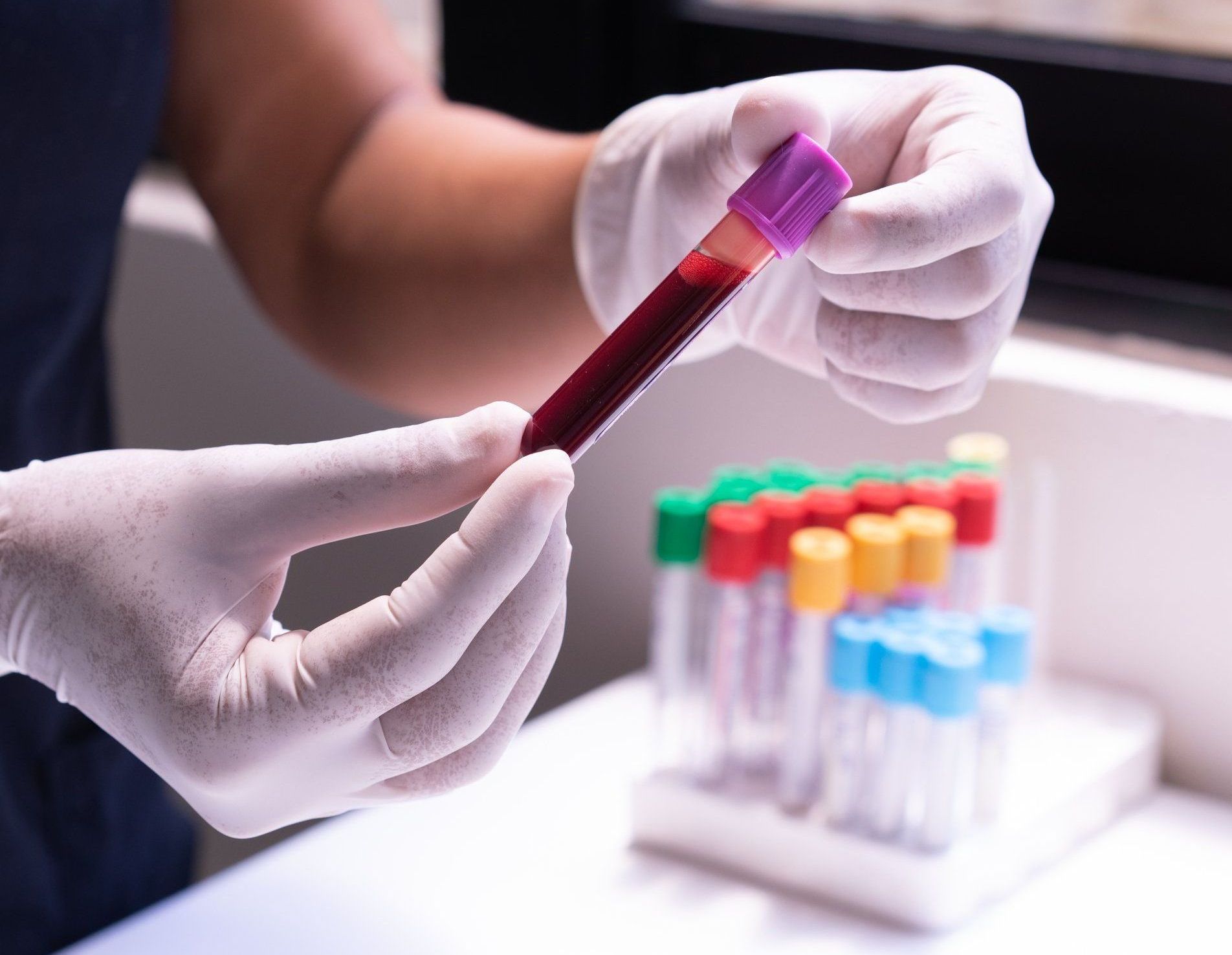 Healthier You, Primary Care - Jodi Tallman, FNP - Lab testng - blood work