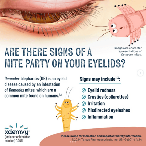 A poster that says are there signs of a mite party on your eyelids