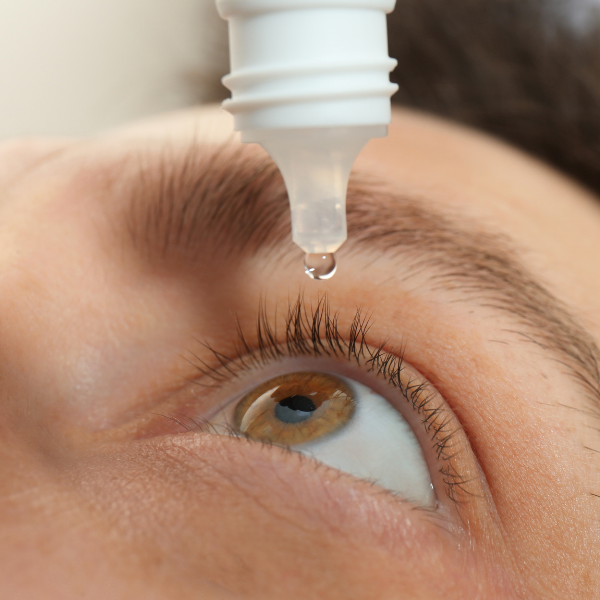 A woman is applying eye drops to her eye
