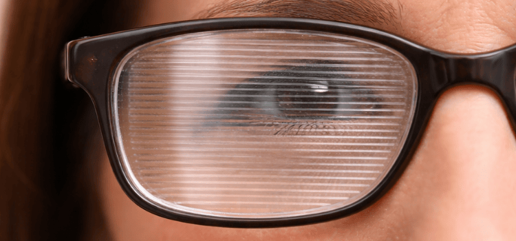 Close-up of a person's eye behind glasses with a fresnel prism.