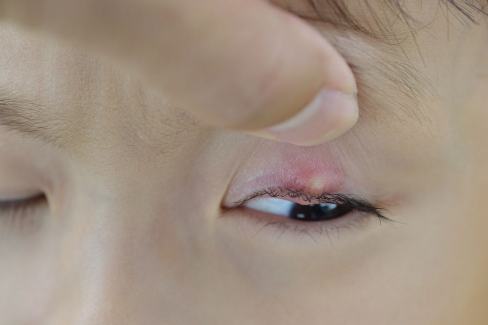 Close-up of a person’s eye being gently pulled open by fingers, showing pink eyeshadow and a contact lens.