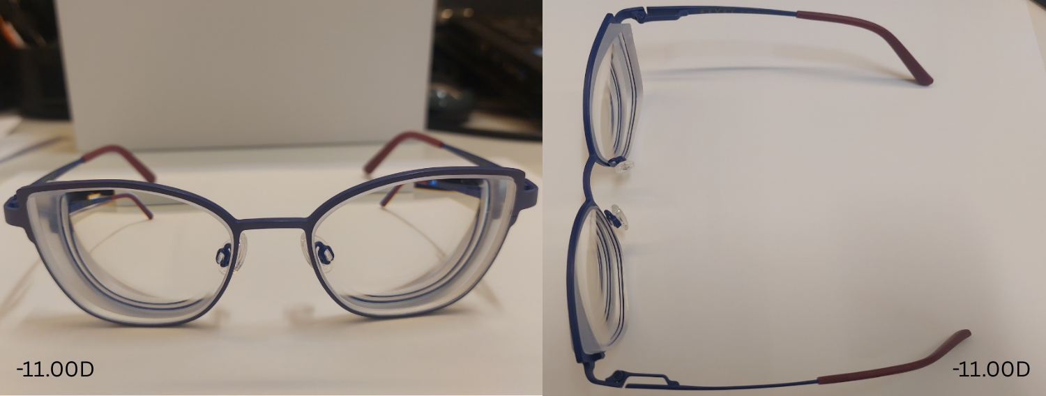 Titanium Frame Prescription -11.00D