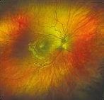 A close up of a person 's eye with a rainbow of colors.