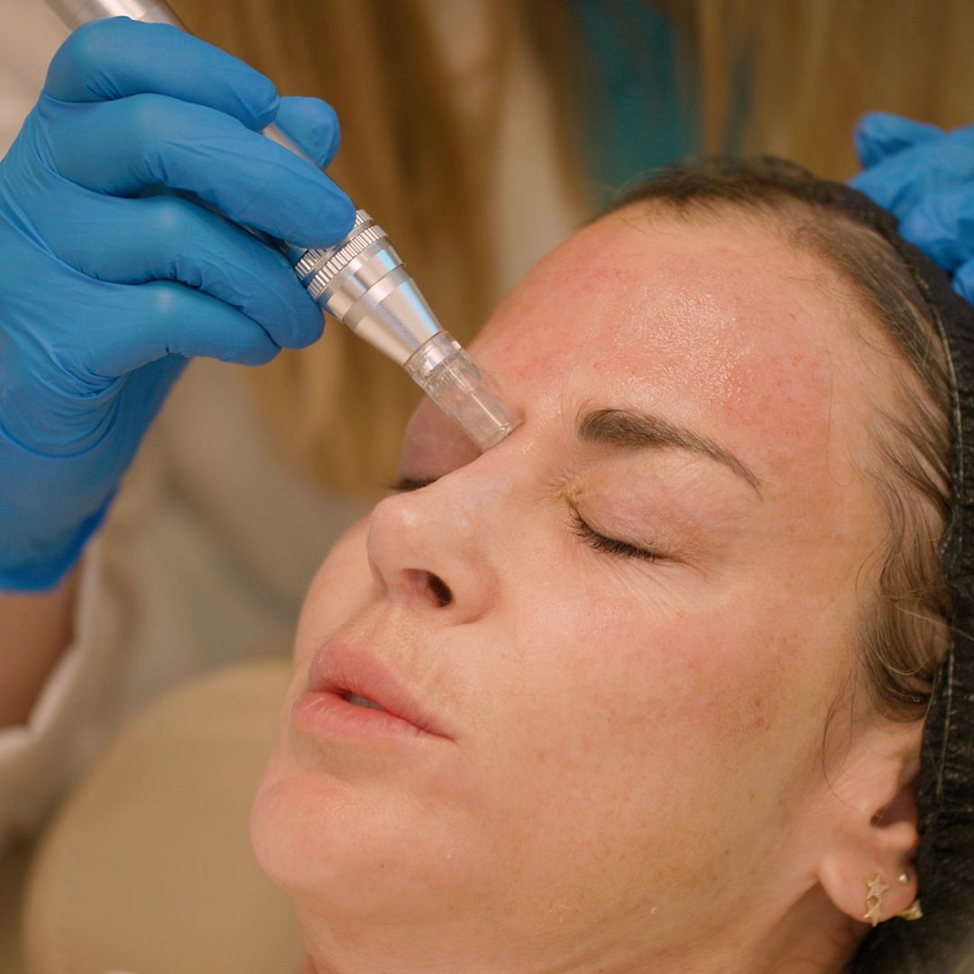 A woman is getting a treatment on her face.