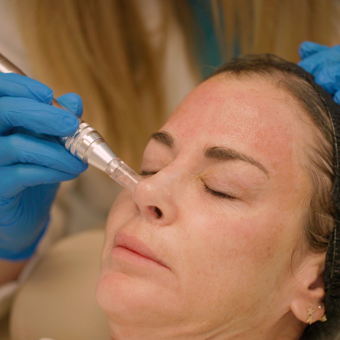 A woman is getting a treatment on her face.