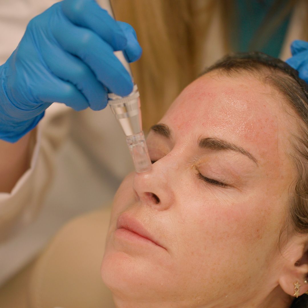 A woman is getting an injection in her nose.