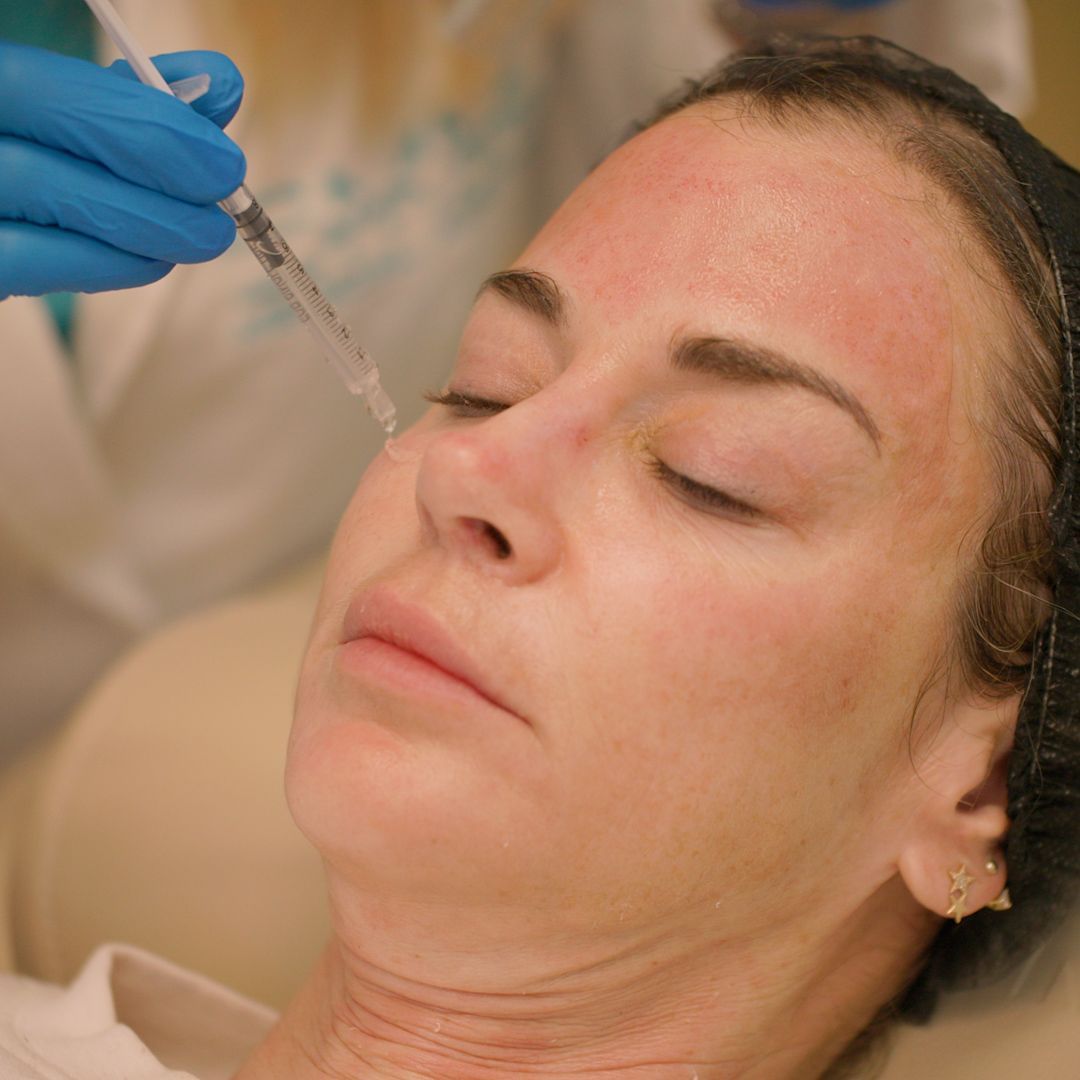 A woman is getting a botox injection in her face.