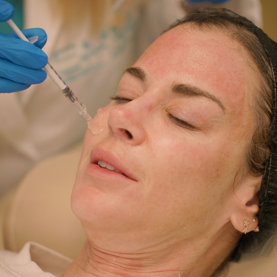 A woman is getting a botox injection in her face.