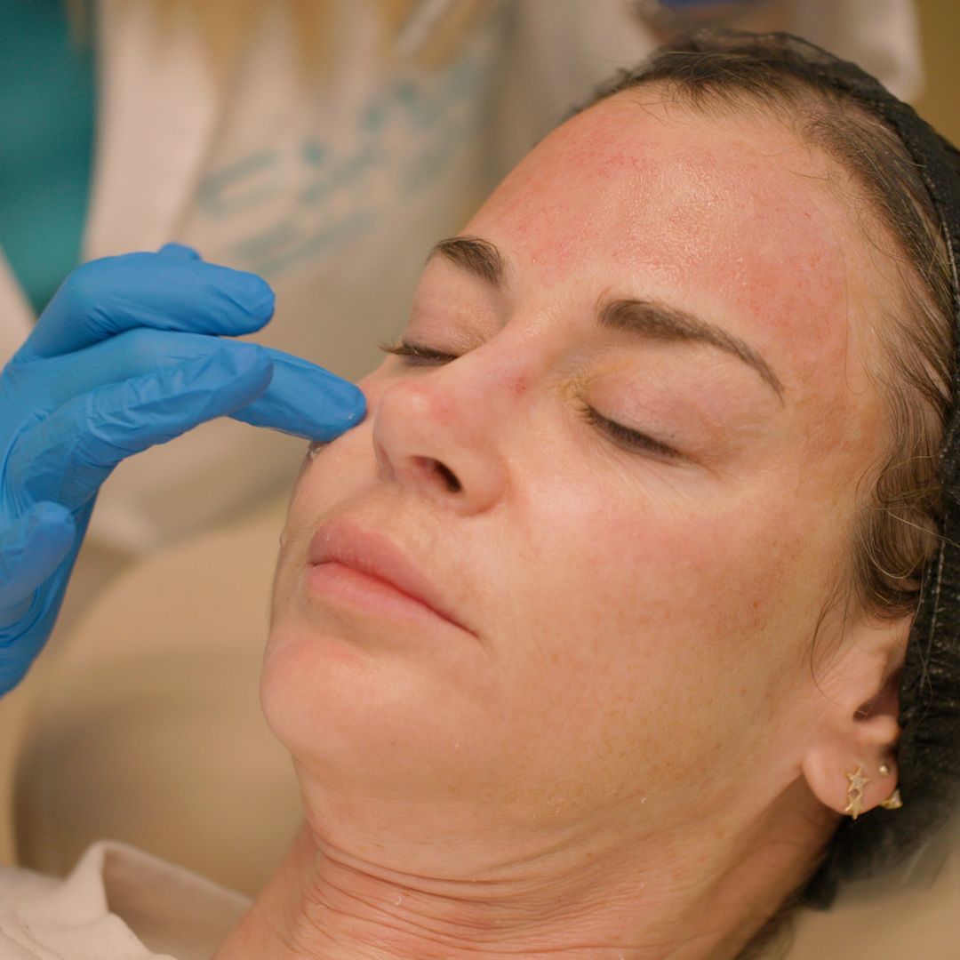 A woman is getting a facial treatment from a doctor wearing blue gloves.