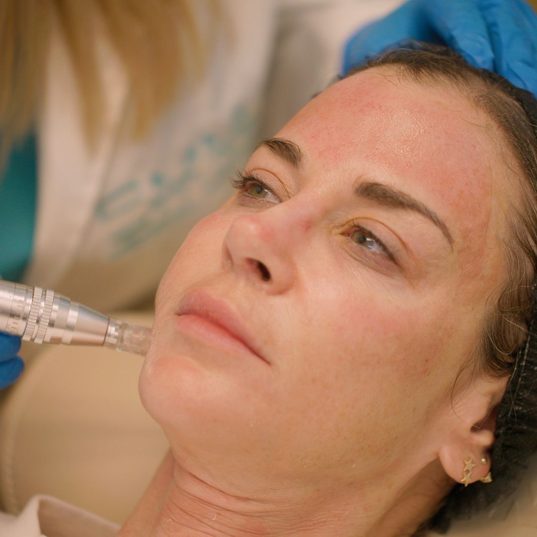 A woman is getting a treatment on her face.