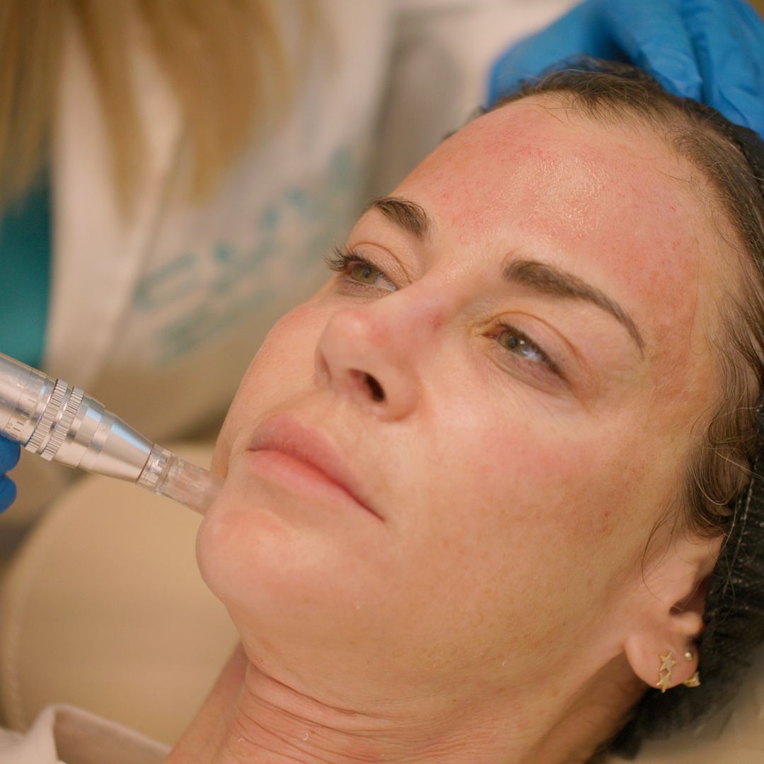 A woman is getting a treatment on her face.