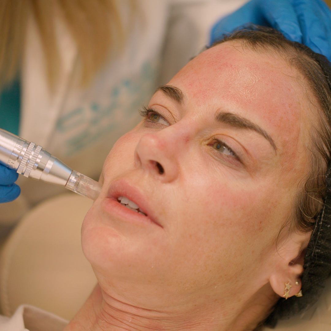 A woman is getting a treatment on her face with a machine.